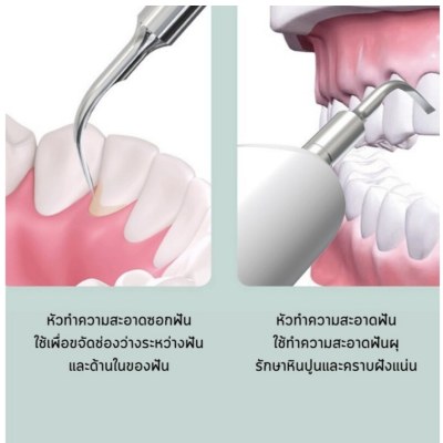 เครื่องขูดหินปูนไฟฟ้า ปรับได้ 3 ระดับ